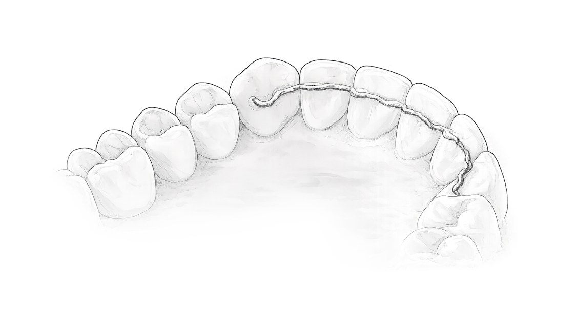 Retainer
